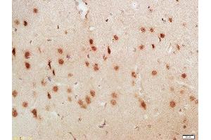 Formalin-fixed and paraffin embedded rat brain labeled with Anti-LUC7L3 Polyclonal Antibody, Unconjugated  at 1:200 followed by conjugation to the secondary antibody and DAB staining (LUC7-Like 3 抗体  (AA 31-130))