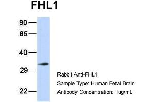 Host: Rabbit Target Name: FHL1 Sample Type: Human Fetal Brain Antibody Dilution: 1. (FHL1 抗体  (N-Term))