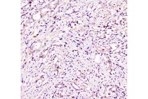 IHC analysis of TANK using anti-TANK antibody (ABIN6719508). (TANK 抗体)