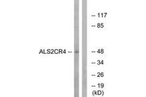 Western blot analysis of extracts from Jurkat cells, using ALS2CR4 Antibody. (TMEM237 抗体  (AA 181-230))