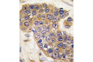 Immunohistochemistry (IHC) image for anti-BCL2 Binding Component 3 (BBC3) (BH3 Domain) antibody (ABIN2997194) (PUMA 抗体  (BH3 Domain))