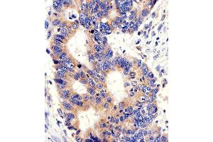 Immunohistochemical analysis of paraffin-embedded H. (PCSK9 抗体  (C-Term))