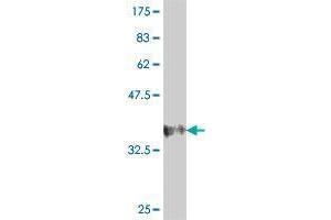 Western Blot detection against Immunogen (37. (MGAT4B 抗体  (AA 401-500))