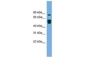 WB Suggested Anti-KIAA1609 Antibody Titration: 0. (KIAA1609 抗体  (N-Term))