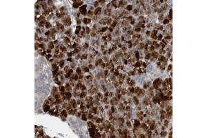 Immunohistochemical staining of human pancreas with FBF1 polyclonal antibody  shows strong cytoplasmic positivity in exocrine glandular cells. (FBF1 抗体)