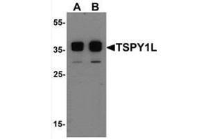 Western blot analysis of TSPY1L in A20 cell lysate with TSPY1L Antibody   at (A) 0. (TSPY1 抗体  (C-Term, Isoform 2))