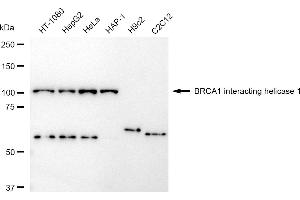 anti-BRCA1 Interacting Protein C-terminal Helicase 1 (BRIP1) antibody