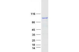 Western Blotting (WB) image for Adaptor Protein, phosphotyrosine Interaction, PH Domain and Leucine Zipper Containing 1 (APPL1) protein (Myc-DYKDDDDK Tag) (ABIN2714846)