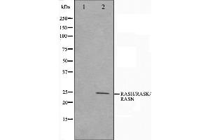 Western blot analysis on HeLa cell lysate using RASH/RASK/RASN Antibody,The lane on the left is treated with the antigen-specific peptide. (RASH/RASK/RASN 抗体)