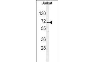 Western blot analysis in Jurkat cell line lysates (35ug/lane). (GAD65 抗体  (AA 109-138))