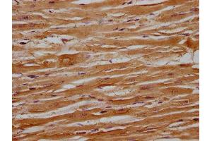 IHC image of ABIN7140094 diluted at 1:100 and staining in paraffin-embedded human heart tissue performed on a Leica BondTM system. (Importin 9 抗体  (AA 158-176))