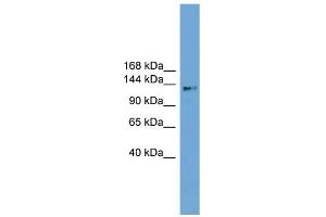 WB Suggested Anti-CCDC146 Antibody Titration: 0. (CCDC146 抗体  (Middle Region))