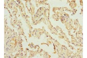 Immunohistochemistry of paraffin-embedded human lung tissue using ABIN7175319 at dilution of 1:100 (VPS4A 抗体  (AA 1-120))