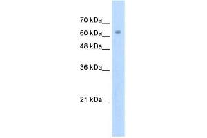 Human Jurkat; WB Suggested Anti-ZNF274 Antibody Titration: 2. (ZNF274 抗体  (N-Term))