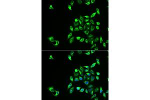 Immunofluorescence analysis of HeLa cells using CSNK1A1L antibody. (CSNK1A1L 抗体)