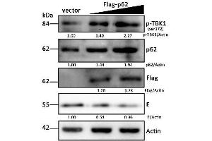 DEF cells were treated as described in Figure 6A, and cells were harvested for Western blot analysis and immunoblotted for p-TBK1 (ABIN746363), p62, Flag, DTMUV-E, and beta-actin. (TBK1 抗体  (pSer172))