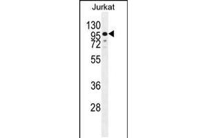 Western blot analysis in Jurkat cell line lysates (35ug/lane). (ZNF841 抗体  (N-Term))