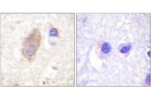 Immunohistochemistry (IHC) image for anti-Rabphilin 3A (RPH3A) (AA 203-252) antibody (ABIN2888698) (RPH3A 抗体  (AA 203-252))
