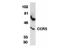 Western Blotting (WB) image for anti-Chemokine (C-C Motif) Receptor 5 (CCR5) (N-Term) antibody (ABIN1031308) (CCR5 抗体  (N-Term))