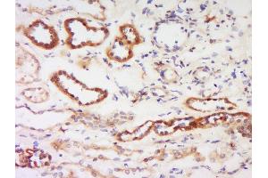 Formalin-fixed and paraffin embedded human kidney labeled with Anti-Protein kinase C beta, Isoform II Polyclonal Antibody, Unconjugated  at 1:200 followed by conjugation to the secondary antibody and DAB staining. (PKC beta 抗体  (AA 601-673))