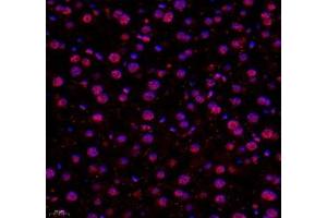 Immunofluorescence of paraffin embedded mouse liver using USP24 (ABIN7076111) at dilution of 1:650 (400x lens) (USP24 抗体)