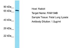 Host: Rabbit Target Name: FAM194B Sample Type: Fetal Lung lysates Antibody Dilution: 1. (FAM194B 抗体  (C-Term))