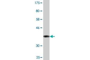 Western Blot detection against Immunogen (36. (Superoxide dismutase copper chaperone 抗体  (AA 175-274))