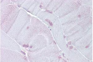 Immunohistochemistry with Skeletal muscle tissue at an antibody concentration of 5µg/ml using anti-TEF antibody (ARP38279_P050) (TEF 抗体  (N-Term))