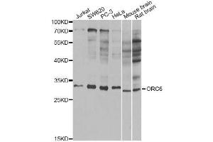 Western blot analysis of extracts of various cell lines, using ORC6 antibody (ABIN5973151) at 1/1000 dilution. (ORC6 抗体)