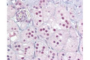 Anti-NUR77 antibody IHC of human adrenal.