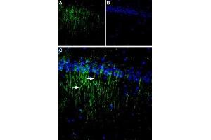 Expression of CaSR in rat brain - Immunohistochemical staining of rat hippocampal CA1 region using Anti-Calcium Sensing Receptor (extracellular) Antibody (ABIN7043018, ABIN7044161 and ABIN7044162). (CASR 抗体  (Extracellular, N-Term))