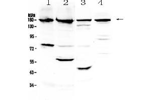 Western blot analysis of ErbB 4 using anti-ErbB 4 antibody . (ERBB4 抗体)
