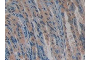 Immunohistochemistry (IHC) image for anti-Cysteine-Rich, Angiogenic Inducer, 61 (CYR61) (AA 176-379) antibody (ABIN7439291)