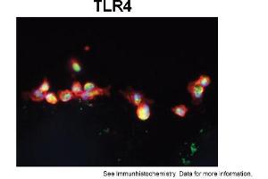 Sample Type: Human Macrophange CellsGreen: primaryRed: phallodinBlue: DAPIYellow: green/redPrimary Dilution: 1:200Secondary Antibody: anti-Rabbit IgG-FITCSecondary Dilution: 1:1000Image Submitted By: Milan FialaUniversity of California, Los Angeles (TLR4 抗体  (Middle Region))
