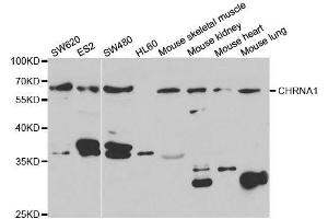 Western blot analysis of extracts of various cell lines, using CHRNA1 antibody. (CHRNA1 抗体  (AA 105-220))