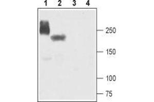 Western blot analysis of human-NaV1. (SCN5A 抗体  (Intracellular))