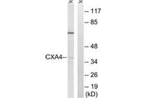 Western blot analysis of extracts from Jurkat cells, using GJA4 Antibody. (GJA4 抗体  (AA 81-130))