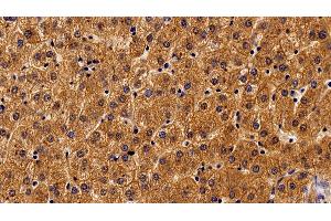 Detection of ALCAM in Human Liver Tissue using Monoclonal Antibody to Activated Leukocyte Cell Adhesion Molecule (ALCAM) (CD166 抗体  (AA 28-527))
