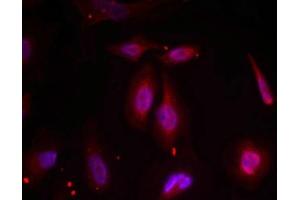 Immunofluorescence staining of methanol-fixed Hela cells using ATF2(Phospho-Thr69 or 51) Antibody.