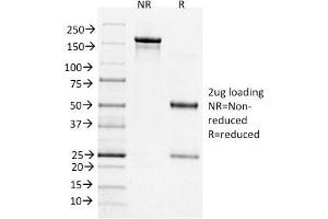 SDS-PAGE Analysis Purified BCL-6 Mouse Monoclonal Antibody (BCL6/1526). (BCL6 抗体  (AA 256-389))