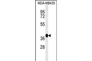 Western blot analysis in MDA-MB435 cell line lysates (35ug/lane). (FBXL14 抗体  (C-Term))