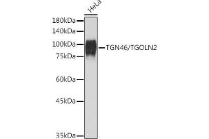 Western blot analysis of extracts of HeLa cells, using TGN46/TGOLN2 Rabbit mAb (ABIN7270875) at 1:1000 dilution. (TGOLN2 抗体)