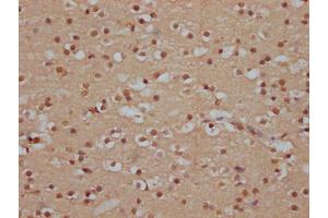 IHC image of ABIN7127821 diluted at 1:100 and staining in paraffin-embedded human brain tissue performed on a Leica BondTM system. (Recombinant SOX1 抗体)