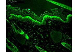 Immunohistochemistry (IHC) image for anti-Heat Shock 27kDa Protein 1 (HSPB1) antibody (ABIN361756)