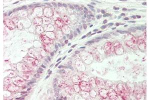 Rabbit Anti-WNK3 antibody  Formalin Fixed Paraffin Embedded Tissue: Human Colon Primary antibody Concentration: 1:100 Secondary Antibody: Donkey anti-Rabbit-Cy3 Secondary Antibody Concentration: 1:200 Magnification: 20x Exposure Time: 0. (WNK3 抗体  (N-Term))