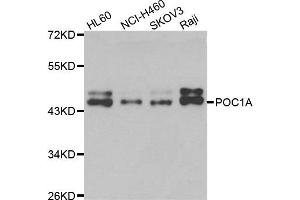 Western blot analysis of extracts of various cell lines, using POC1A antibody. (POC1A 抗体)