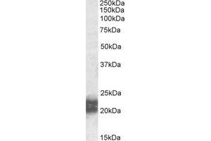 Western Blotting (WB) image for anti-Niemann-Pick Disease, Type C2 (NPC2) (AA 18-31) antibody (ABIN490668) (NPC2 抗体  (AA 18-31))