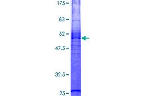 MC3R Protein (AA 1-360) (GST tag)