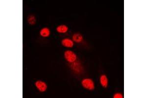 Immunofluorescent analysis of SYNE3 staining in HepG2 cells. (Nesprin3 抗体  (Center))