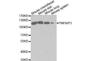 Western blot analysis of extracts of various cell lines, using TNFAIP3 antibody. (TNFAIP3 抗体  (AA 1-190))